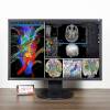 Màn hình 24 Inch Eizo Flexscan  EV2430 chuyên đồ họa